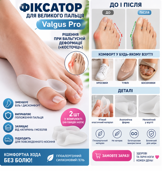 Фіксатор великого пальця ноги Valgus Pro силіконовий, коректор від кісточки, 2 шт. 3900 фото