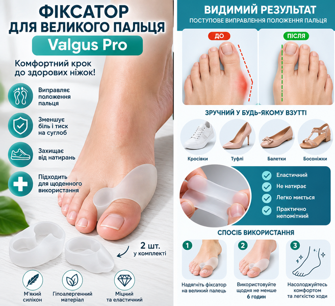 Фіксатор великого пальця ноги Valgus Pro силіконовий, коректор від кісточки, 2 шт. 3900 фото